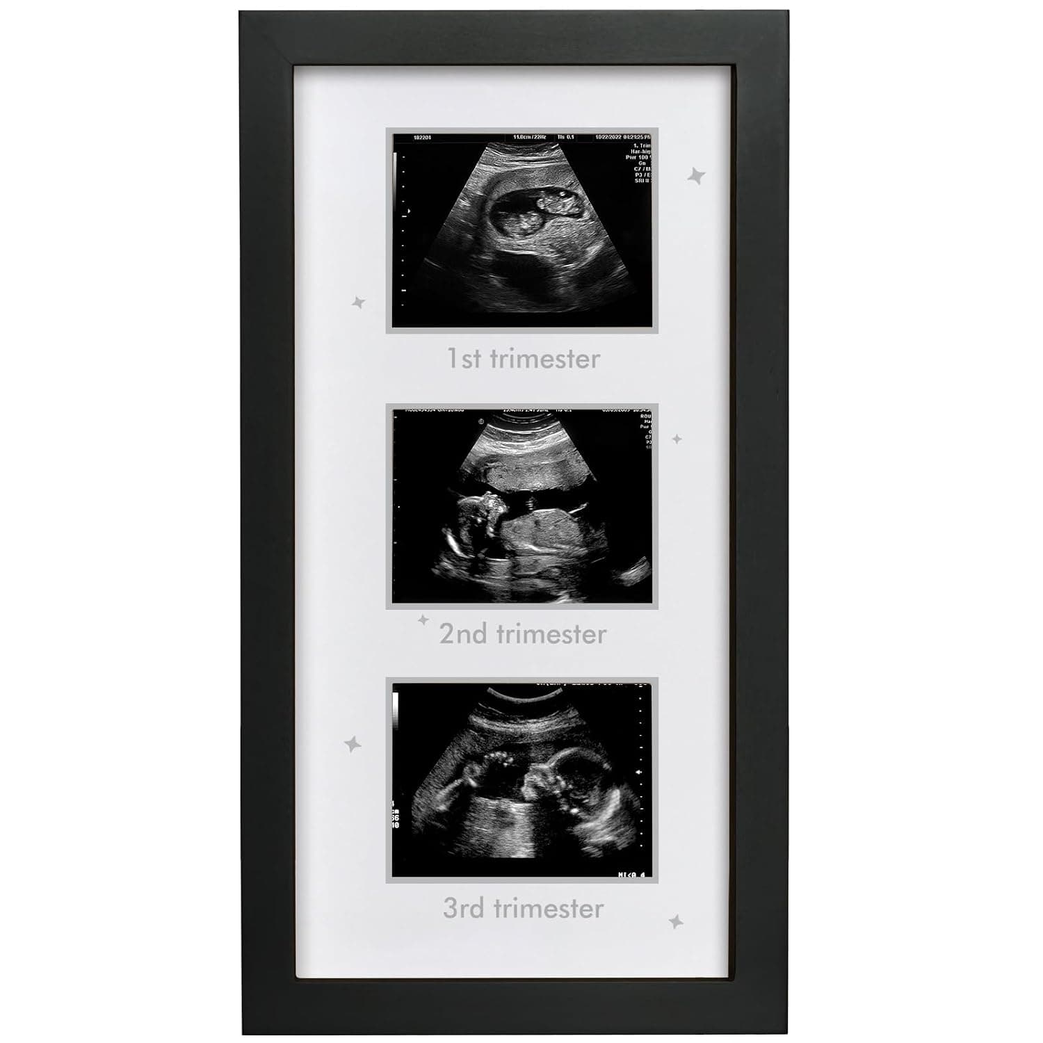 Ultrasound Picture Frame - Triple Sonogram Frame for Mom to Be | Pregnancy Photo Album Decor | Baby Nursery Essentials & Gender Reveal Gifts | First Trimester Keepsake & Pregnancy Must Haves