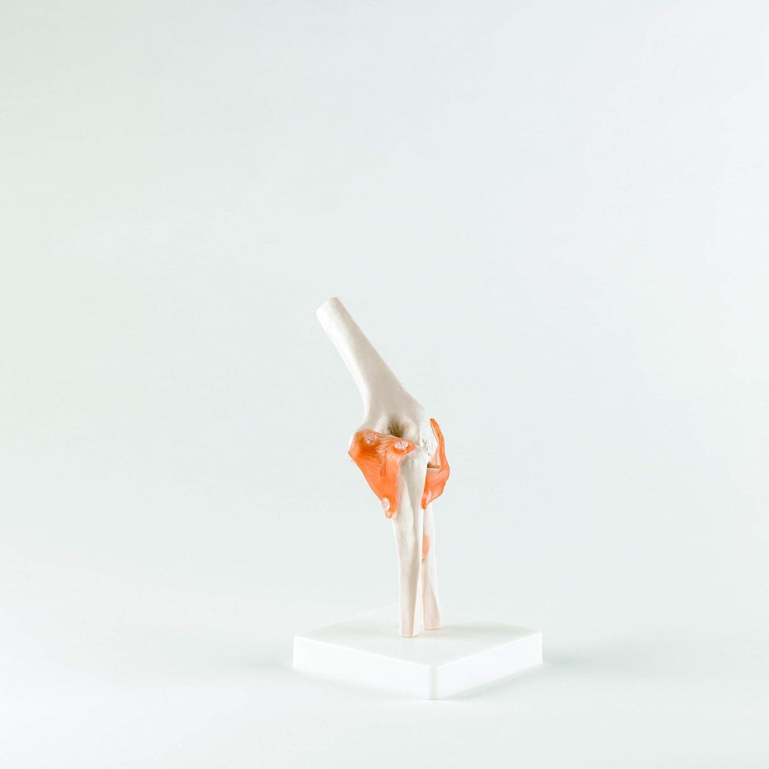 Patterson Elbow Joint