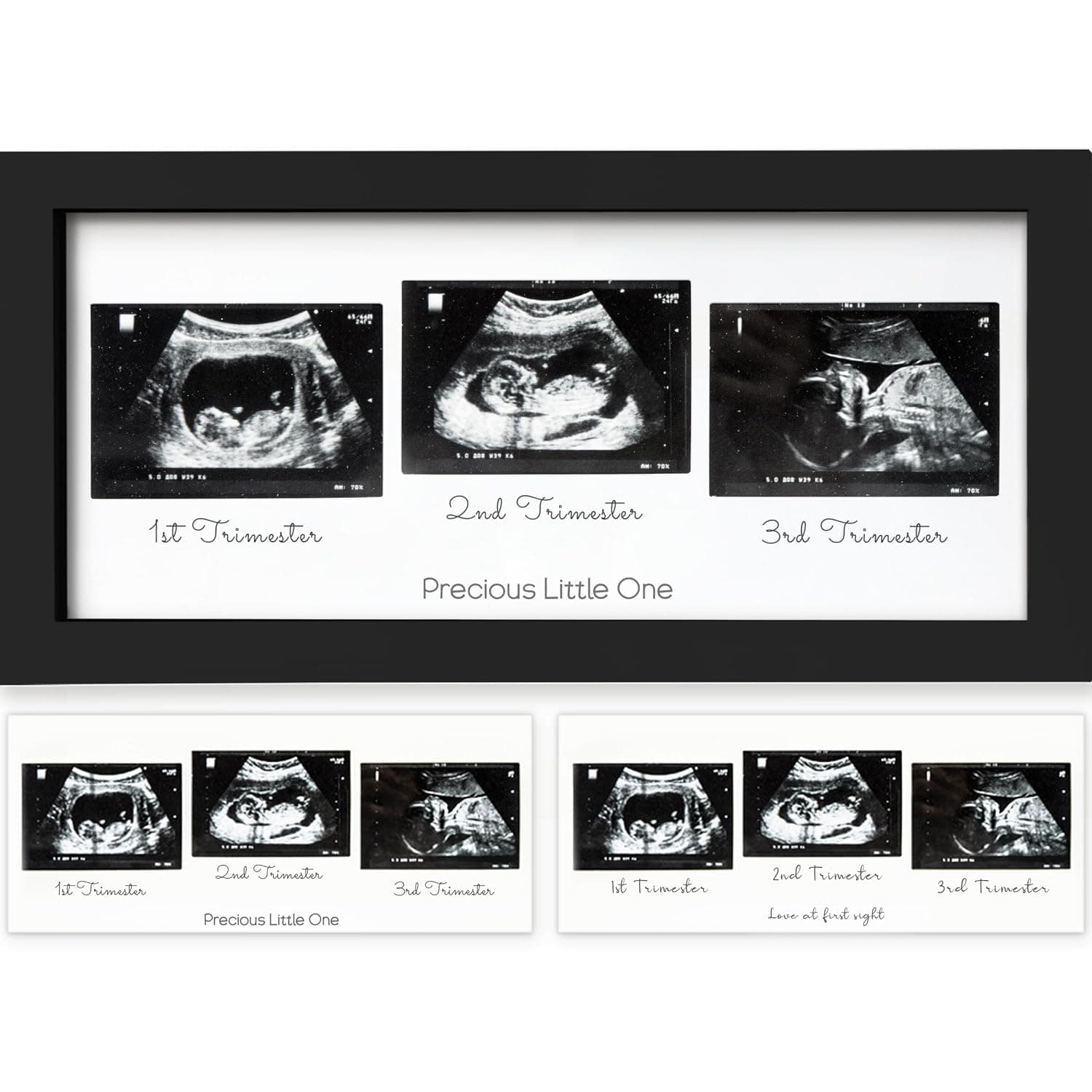 Sonogram Picture Frame - Trio Ultrasound Picture Frames For Mom To Be Gift - Baby Ultrasound frame - Pregnancy Announcements Sonogram frame - Baby Nursery Decor, Pregnant Mom Gifts (Onyx Black)