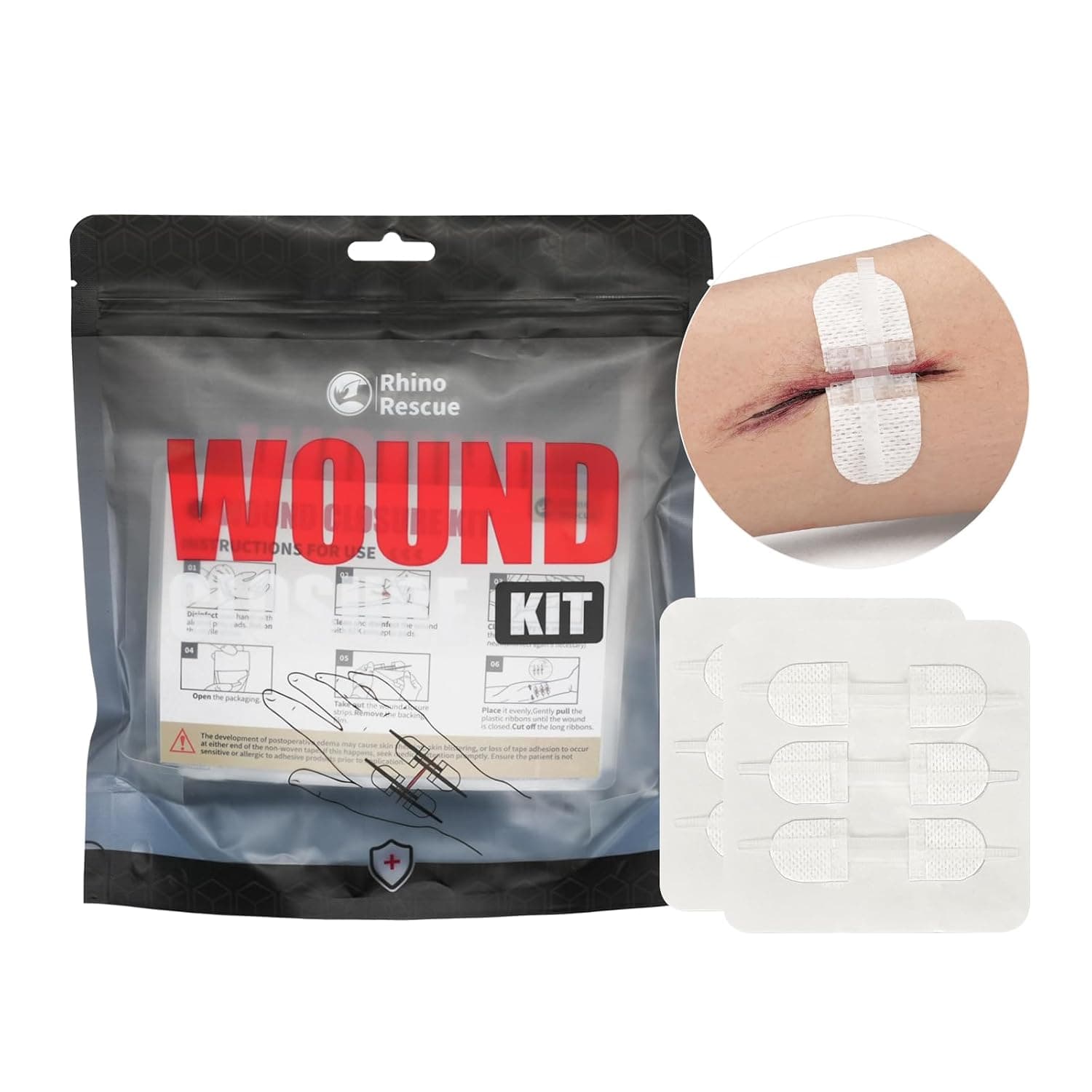 RHINO RESCUE Zip Stitch 6pcs with Wound Dresssings, Closure Strips Without Suture, Zipstitch Laceration Kit for Cut Care, Adhesive Bandages | Wound Closure Strips, Stitchless & Painless Stitch Zip, Laceration Closure First Aid Kit, HSA/FSA Approved