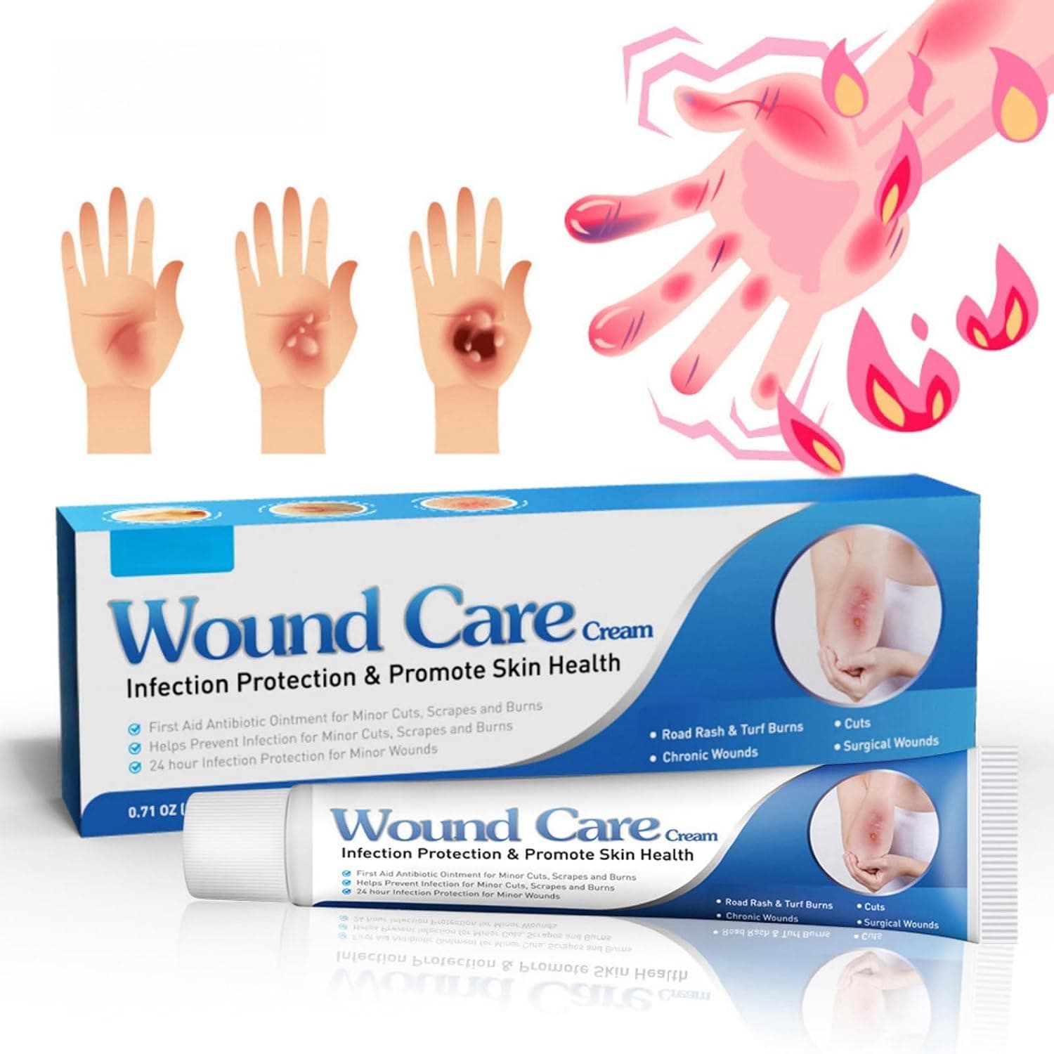 Wound Care Cream 20g, Burn Relief Ointment for Soothing & Cooling, Ideal for Treating Burns & Scalds, Prevents Infection, Protects Skin Health, Lowers Skin Temperature to Halt Burn Progression